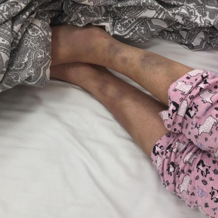 Məşhur müğənni avtomobil qəzasında tanınmaz hala düşdü - FOTO